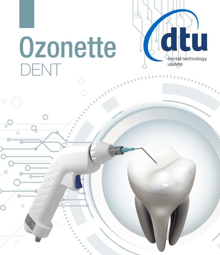 Ozonette - O3 in Odontoiatria